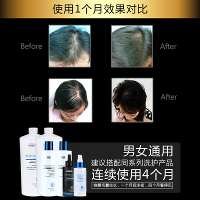 科技賦能防脫，歐萊雅芯基源洗護套裝 深入發芯，重塑強韌發絲