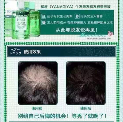 產后脫發怎么辦？這些方法幫你減少掉發，拒絕禿頂危機
